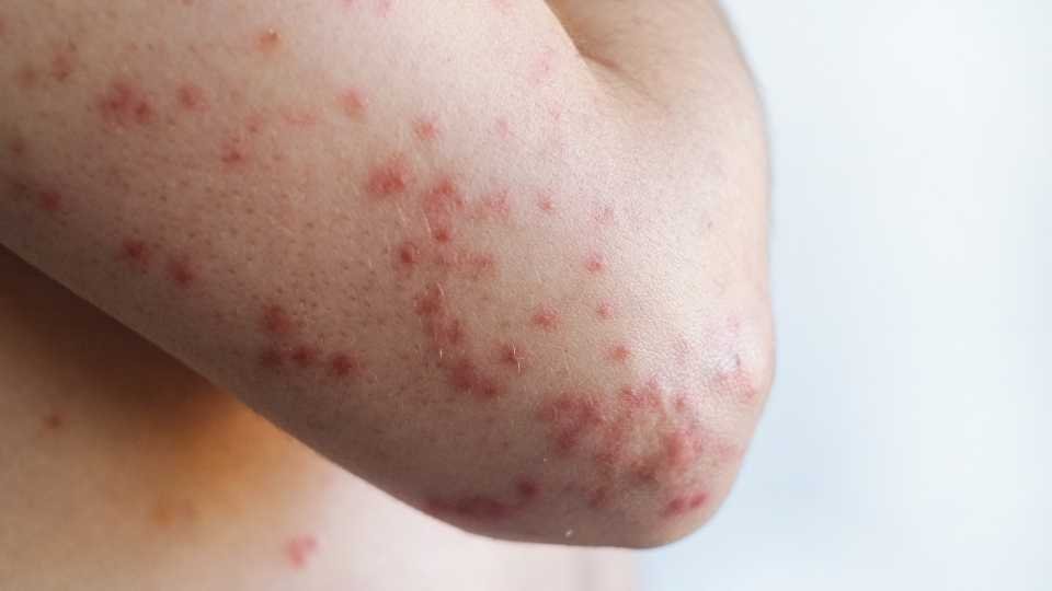 Macrobrigada de vacunación contra el sarampión en la Explanada de los Héroes