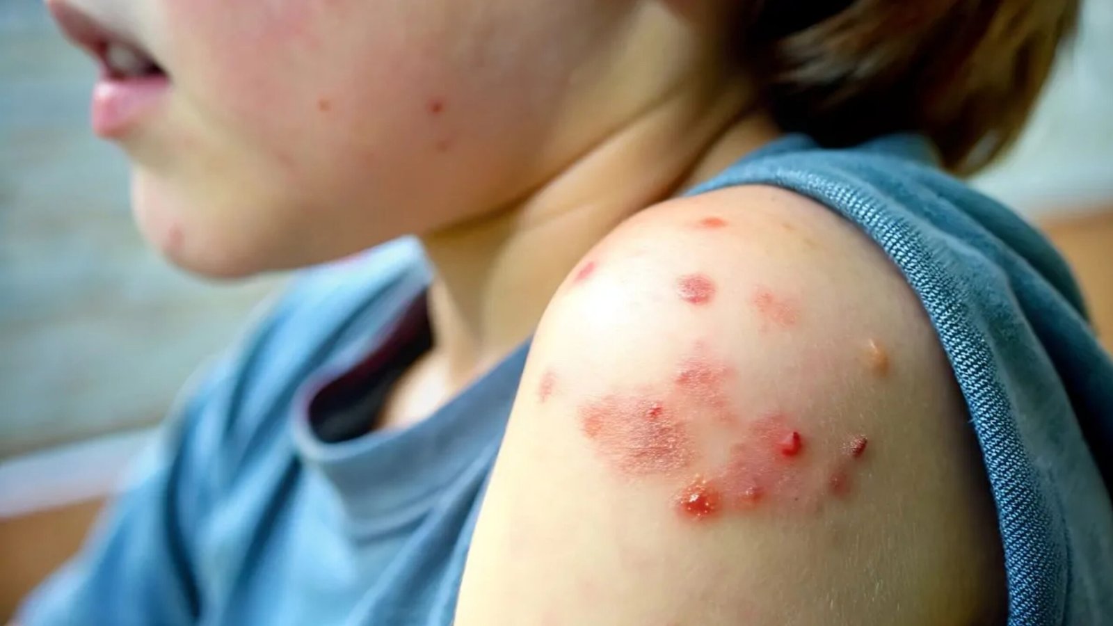 Plecas e informacion - 2026-02-17T122710.983