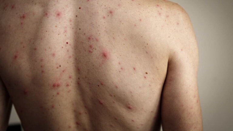 Plecas e informacion - 2026-02-22T095100.555