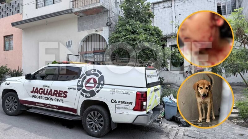 Menor de 3 años es atacada por un perro en Santa Catarina