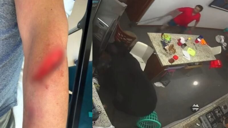 Oso hiere a hombre en San Pedro; reportan otros dos incidentes