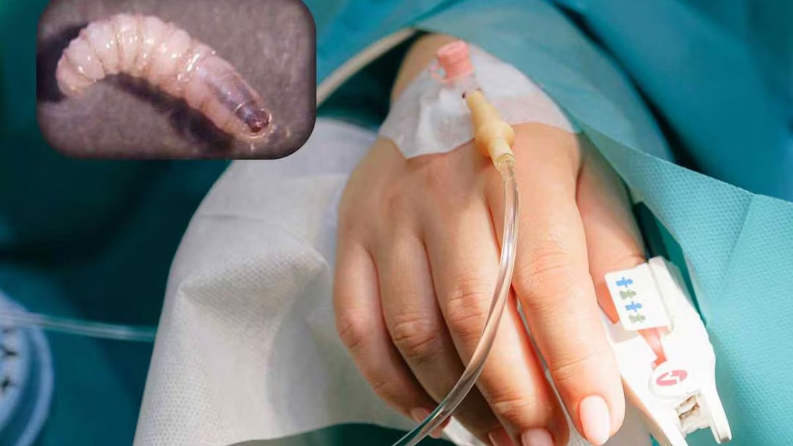 México suma 692 casos de gusano barrenador en humanos; 575 se registraron en 2026